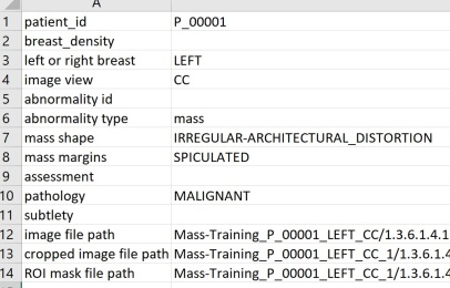 This is the metadata attached to a breast image of patient 1 in the MASS-dataset. A Cranial-Caudal view of the left breast is associated to the file (with path to image given at the bottom). A malignant mass is observed.